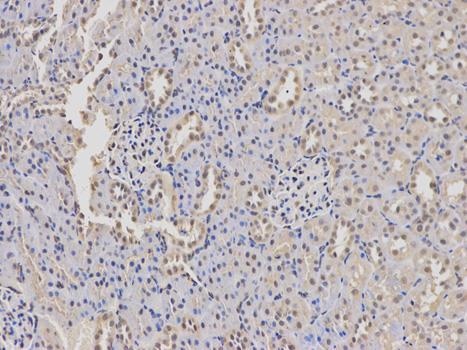 WAS / WASP Antibody - Immunohistochemistry of paraffin-embedded rat kidney using WAS antibody at dilution of 1:100 (200x lens).