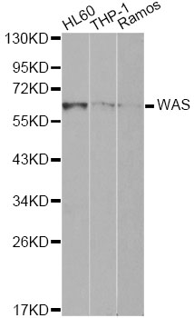 WAS / WASP Antibody - Western blot analysis of extracts of various cell lines, using WAS antibody at 1:1000 dilution. The secondary antibody used was an HRP Goat Anti-Rabbit IgG (H+L) at 1:10000 dilution. Lysates were loaded 25ug per lane and 3% nonfat dry milk in TBST was used for blocking. An ECL Kit was used for detection.