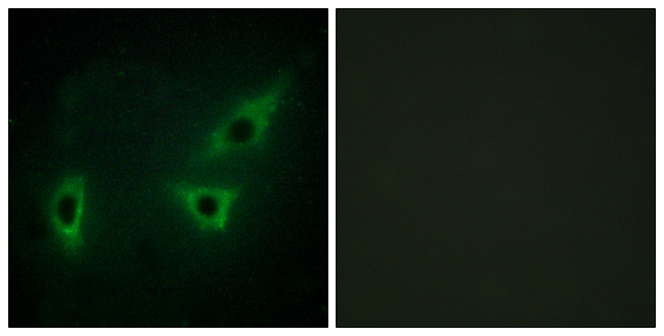 WC1 / ATP7B Antibody - Immunofluorescence analysis of HeLa cells, using ATP7B Antibody. The picture on the right is blocked with the synthesized peptide.