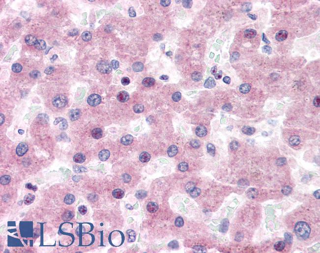 WC1 / ATP7B Antibody - Anti-ATP7B antibody IHC of human liver. Immunohistochemistry of formalin-fixed, paraffin-embedded tissue after heat-induced antigen retrieval. Antibody concentration 5 ug/ml.  This image was taken for the unconjugated form of this product. Other forms have not been tested.