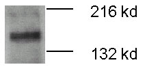 WC1 / ATP7B Antibody - ATP7b detected in 20 ug of mouse brain membrane fraction using WC1 / ATP7B Antibody. This image was taken for the unconjugated form of this product. Other forms have not been tested.