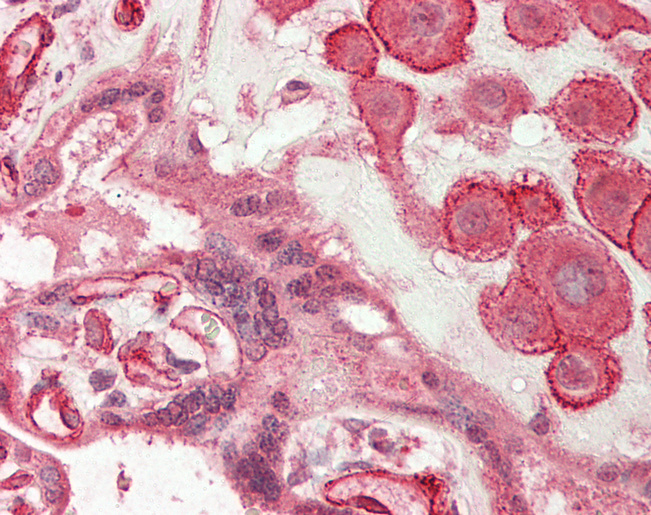 WDFY3 / ALFY Antibody - Human Placenta: Formalin-Fixed, Paraffin-Embedded (FFPE)