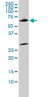 WDR20 Antibody - WDR20 monoclonal antibody, clone 2A6 Western blot of WDR20 expression in HeLa NE.