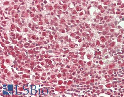 WDR5 Antibody - Human Tonsil: Formalin-Fixed, Paraffin-Embedded (FFPE)