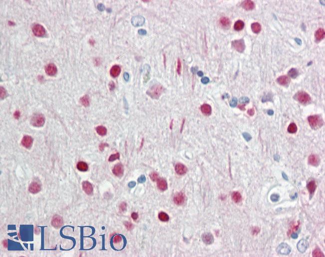 WDR5 Antibody - Anti-WDR5 antibody IHC staining of human brain, cortex. Immunohistochemistry of formalin-fixed, paraffin-embedded tissue after heat-induced antigen retrieval.