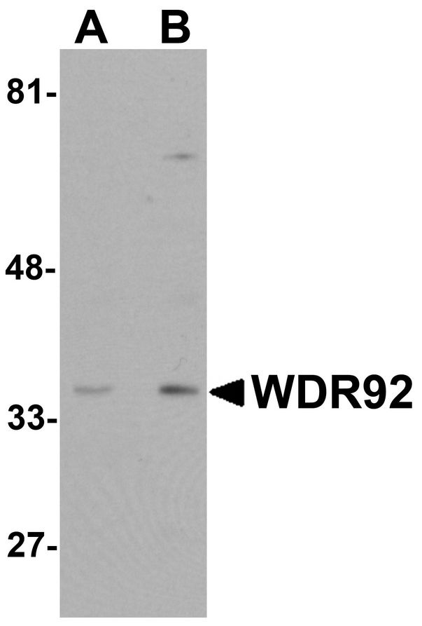WDR92 Antibody - Western blot analysis of WDR92 in human kidney tissue lysate with WDR92 antibody at (A) 1 and (B) 2 ug/ml.