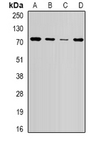 WHSC1 / NSD2 Antibody - Western blot analysis of NSD2 expression in HepG2 (A); SW620 (B); mouse brain (C); mouse spleen (D) whole cell lysates.