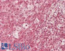 WHSC1 / NSD2 Antibody - Human Tonsil: Formalin-Fixed, Paraffin-Embedded (FFPE)