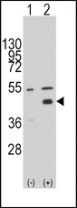 WIF1 Antibody - Western blot of WIF1 (arrow) using rabbit polyclonal WIF1 Antibody. 293 cell lysates (2 ug/lane) either nontransfected (Lane 1) or transiently transfected with the WIF1 gene (Lane 2) (Origene Technologies).