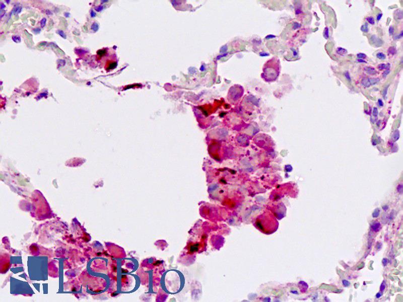 WIF1 Antibody - Human Lung: Formalin-Fixed, Paraffin-Embedded (FFPE)