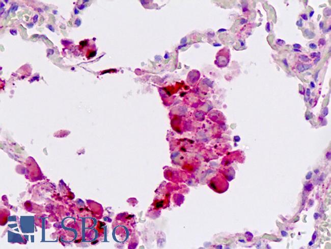 WIF1 Antibody - Human Lung: Formalin-Fixed, Paraffin-Embedded (FFPE)
