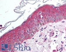 WNT10B Antibody - Anti-WNT10B antibody IHC of human skin. Immunohistochemistry of formalin-fixed, paraffin-embedded tissue after heat-induced antigen retrieval.