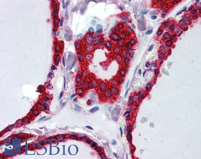 WNT5A Antibody - Anti-WNT5A antibody IHC of human thyroid. Immunohistochemistry of formalin-fixed, paraffin-embedded tissue after heat-induced antigen retrieval. Antibody dilution 1:200.