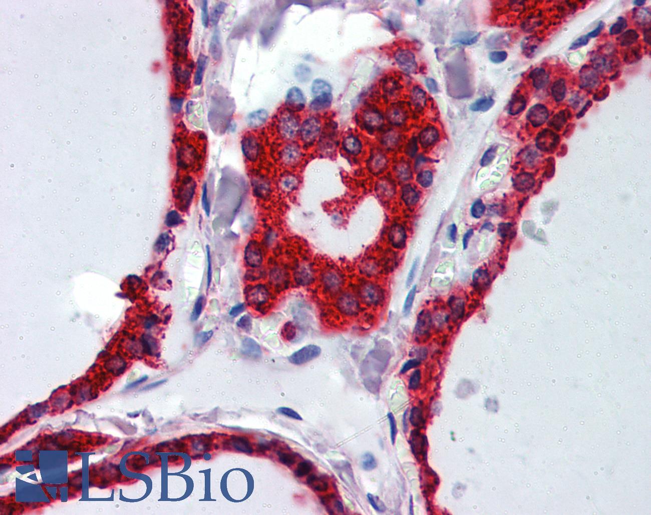 WNT5A Antibody - Anti-WNT5A antibody IHC of human thyroid. Immunohistochemistry of formalin-fixed, paraffin-embedded tissue after heat-induced antigen retrieval. Antibody dilution 1:200.