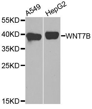 WNT7B Antibody - Western blot analysis of extracts of various cell lines.