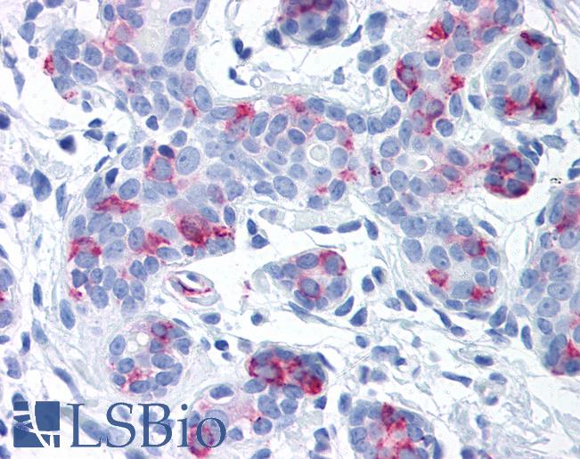 WNT8A Antibody - Anti-WNT8A antibody IHC of human breast. Immunohistochemistry of formalin-fixed, paraffin-embedded tissue after heat-induced antigen retrieval.
