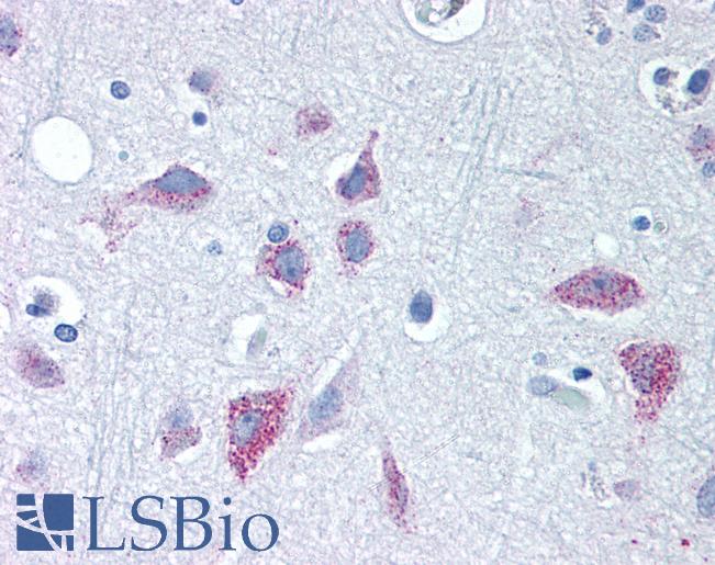 WNT8B / Wnt 8b Antibody - Anti-WNT8B antibody IHC of human brain, cortex. Immunohistochemistry of formalin-fixed, paraffin-embedded tissue after heat-induced antigen retrieval.