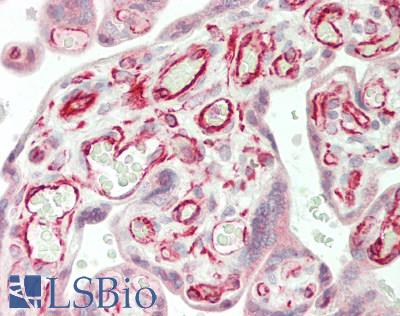 WRN Antibody - Human Placenta: Formalin-Fixed, Paraffin-Embedded (FFPE)