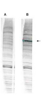 WRNIP1 / WHIP Antibody - Anti-Human WHIP Antibody - Western Blot. Western blot analysis is shown using anti-Human WHIP antibody with and without pre-incubation with blocking peptide. Testing was performed on antiserum prior to affinity purification. Peptide competition (left) blocks the specific staining, whereas the control (right) shows staining of a strong dominant band corresponding to human WHIP1. ~30 ug of HEK293 lysate was loaded per lane for 4-20% gradient SDS-PAGE. Comparison to a molecular weight marker (not shown) indicates a band of ~96.0 kD is detected. The blot was incubated with a 1:1000 dilution of the antibody at room temperature for 2 h followed by detection using IRDye 800 labeled Goat-a-Rabbit IgG [H&L] MX10 ( diluted 1:5000 for 45 min. IRDye 800 fluorescence image was captured using the Odyssey Infrared Imaging System developed by LI-COR. IRDye is a trademark of LI-COR, Inc. Other systems will yield similar results.