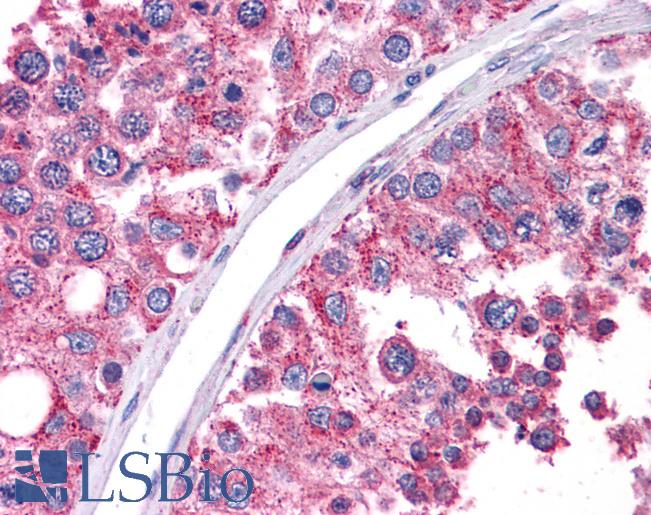 WT1 / Wilms Tumor 1 Antibody - Anti-WT1 antibody IHC of human testis. Immunohistochemistry of formalin-fixed, paraffin-embedded tissue after heat-induced antigen retrieval. Antibody concentration 5 ug/ml.  This image was taken for the unconjugated form of this product. Other forms have not been tested.
