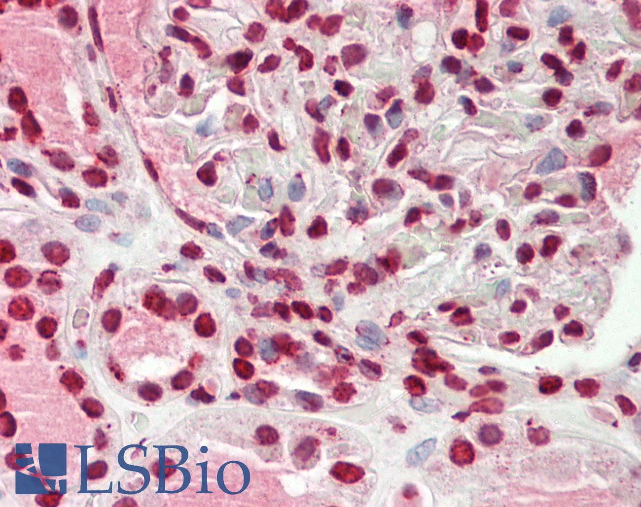 WTAP Antibody - Human Kidney: Formalin-Fixed, Paraffin-Embedded (FFPE)