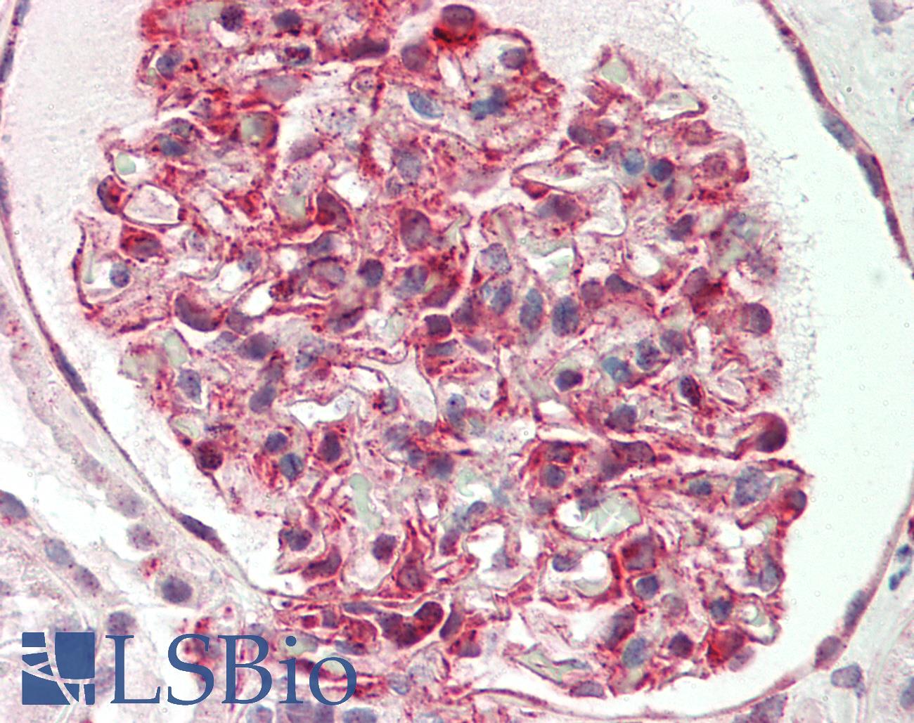 WTAP Antibody - Human Kidney: Formalin-Fixed, Paraffin-Embedded (FFPE)