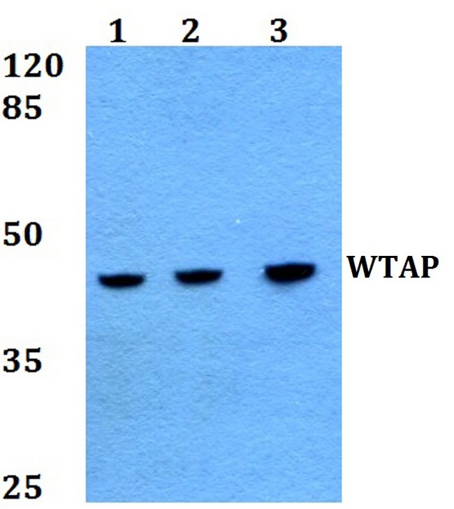 WTAP Antibody - Western blot analysis of WTAP Antibody at 1:500 dilution. Lane 1: HepG2 whole cell lysate. Lane 2: Raw264.7 whole cell lysate. Lane 3: PC12 whole cell lysate.