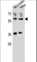 WTIP Antibody - WTIP Antibody western blot of NCI-H460,WiDr cell line lysates (35 ug/lane). The WTIP antibody detected the WTIP protein (arrow).