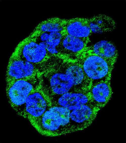 WTIP Antibody - Confocal immunofluorescence of WTIP Antibody with WiDr cell followed by Alexa Fluor 488-conjugated goat anti-rabbit lgG (green). DAPI was used to stain the cell nuclear (blue).