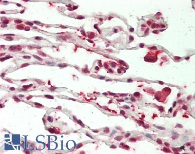WTIP Antibody - Human Lung: Formalin-Fixed, Paraffin-Embedded (FFPE)