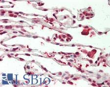 WTIP Antibody - Human Lung: Formalin-Fixed, Paraffin-Embedded (FFPE)