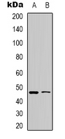 WWOX Antibody - Western blot analysis of WWOX (pY33) expression in Raji (A); HepG2 (B) whole cell lysates.