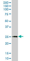 XBP1 Antibody - XBP1 monoclonal antibody (M05), clone 2D9. Western blot of XBP1 expression in human stomach.