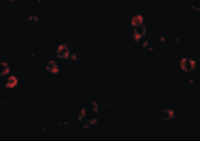 XBP1 Antibody - Immunofluorescence of XBP1 in HepG2 cells with XBP1 antibody at 4 ug/ml.
