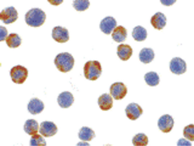 XBP1 Antibody - Immunocytochemistry of XBP-1 in HepG2 cells with XBP-1 antibody at 2 ug/ml.