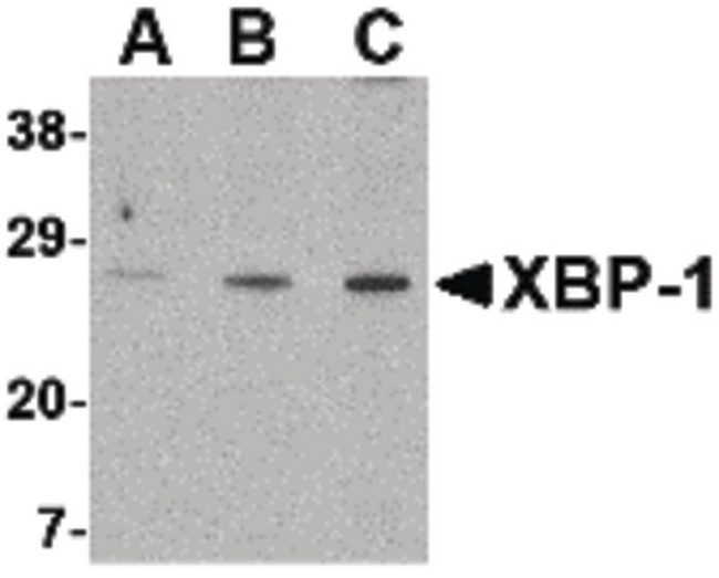 XBP1 Antibody - Western blot of XBP-1 in PC-3 cell lysate with XBP-1 antibody at (A) 0.5, (B) 1 and (C) 2 ug/ml.