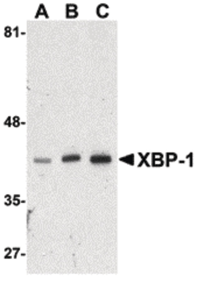 XBP1 Antibody - Western blot of XBP-1 in HepG2 cell lysate with XBP-1 antibody at (A) 0.5, (B) 1 and (C) 2 ug/ml.