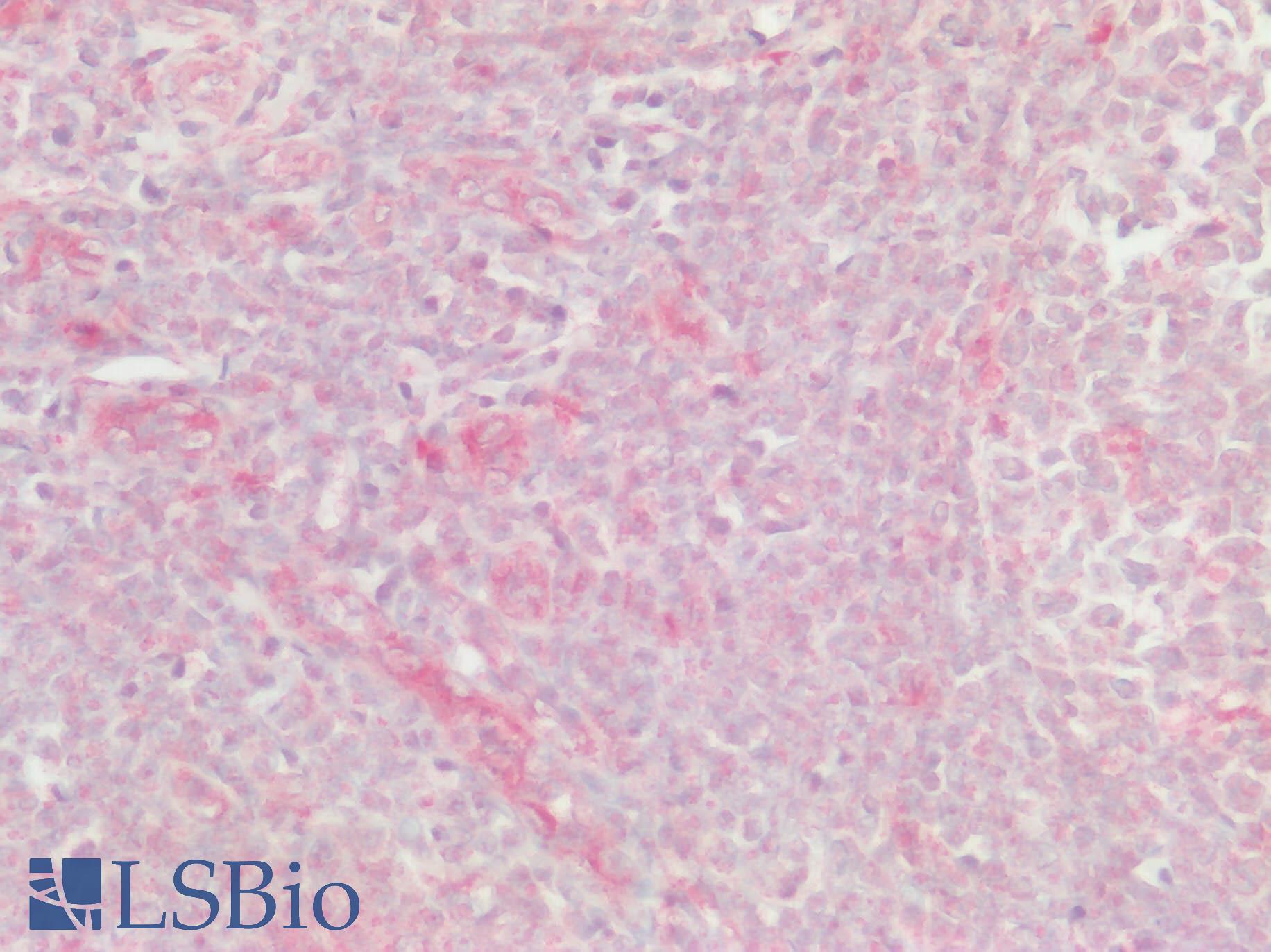 XCR1 Antibody - Human Tonsil: Formalin-Fixed, Paraffin-Embedded (FFPE)