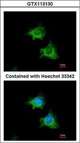 XIAP Antibody - Immunofluorescence of methanol-fixed HeLa, using BIRC4 antibody at 1:100 dilution.