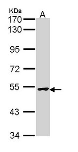 XIAP Antibody - Sample (30 ug of whole cell lysate). A: Hela. 7.5% SDS PAGE. XIAP antibody diluted at 1:1000. 