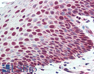 XPC Antibody - Human Tonsil: Formalin-Fixed, Paraffin-Embedded (FFPE)