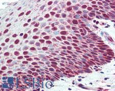 XPC Antibody - Human Tonsil: Formalin-Fixed, Paraffin-Embedded (FFPE)