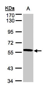 XPNPEP3 Antibody - Sample (30 ug whole cell lysate). A: A431. 7.5% SDS PAGE. XPNPEP3 antibody diluted at 1:500