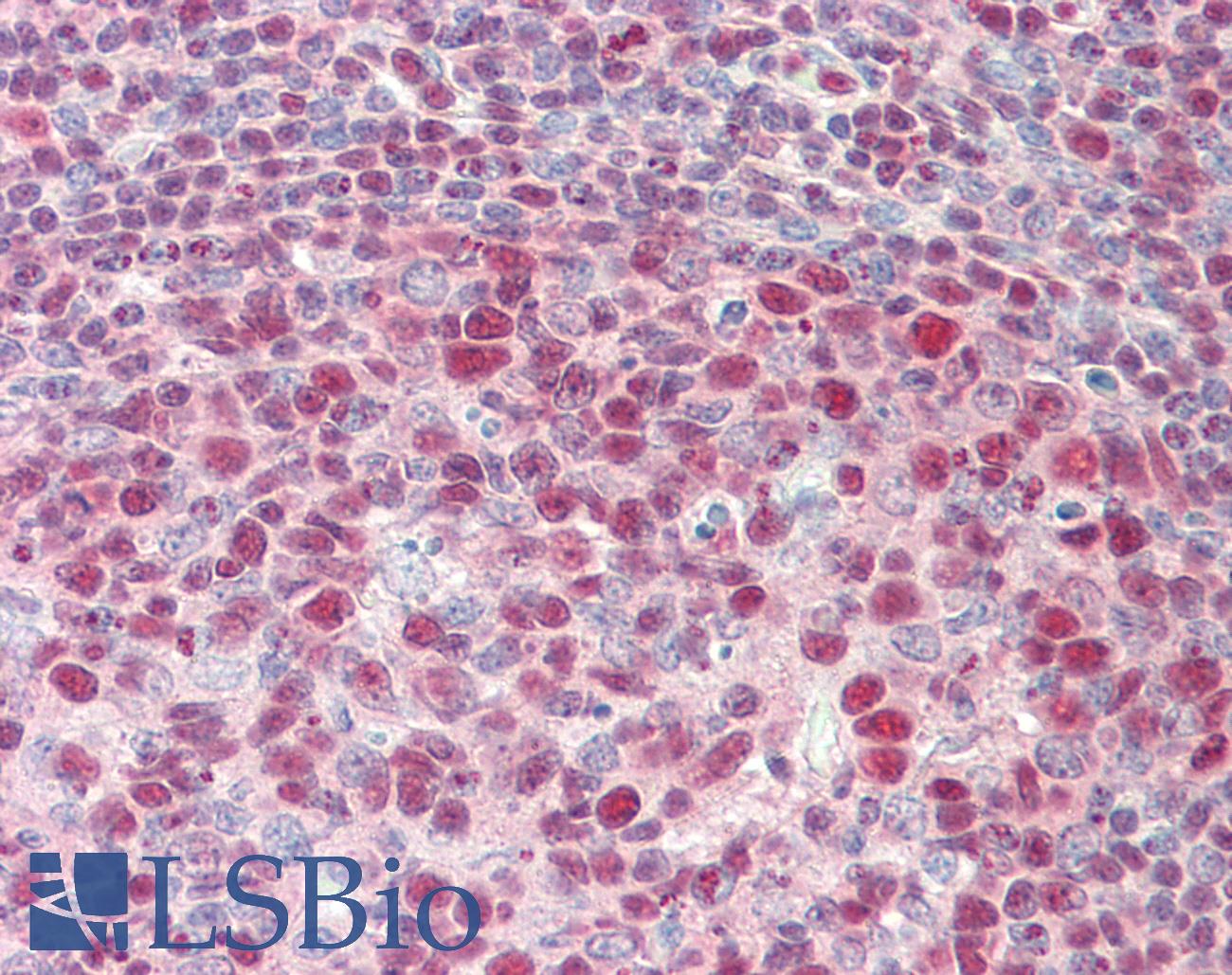 XPO1 / CRM1 Antibody - Anti-XPO1 / CRM1 antibody IHC staining of human tonsil. Immunohistochemistry of formalin-fixed, paraffin-embedded tissue after heat-induced antigen retrieval. Antibody concentration 5 ug/ml.