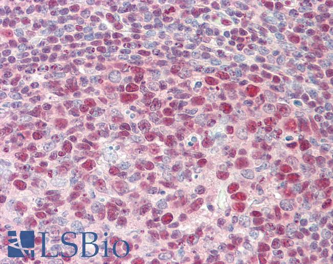 XPO1 / CRM1 Antibody - Anti-XPO1 / CRM1 antibody IHC staining of human tonsil. Immunohistochemistry of formalin-fixed, paraffin-embedded tissue after heat-induced antigen retrieval. Antibody concentration 5 ug/ml.