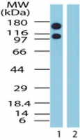 XPO1 / CRM1 Antibody - Western blot of Exportin-1 in Jurkat cell lysate in the 1) absence and 2) presence of immunizing peptide using antibody at 1.5 ug/ml.