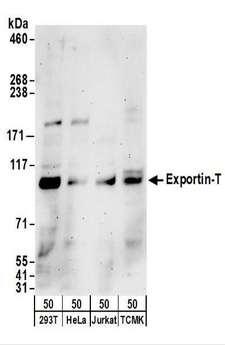 XPOT / Exportin-T Antibody - Detection of Human and Mouse Exportin-T by Western Blot. Samples: Whole cell lysate (50 ug) from 293T, HeLa, Jurkat, and mouse TCMK-1 cells. Antibodies: Affinity purified rabbit anti-Exportin-T antibody used for WB at 0.4 ug/ml. Detection: Chemiluminescence with an exposure time of 3 minutes.