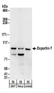 XPOT / Exportin-T Antibody - Detection of Human Exportin-T by Western Blot. Samples: Whole cell lysate (50 ug) from 293T, HeLa, and Jurkat cells. Antibodies: Affinity purified rabbit anti-Exportin-T antibody used for WB at 0.4 ug/ml. Detection: Chemiluminescence with an exposure time of 3 minutes.