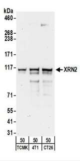 XRN2 Antibody - Detection of Mouse XRN2 by Western Blot. Samples: Whole cell lysate (50 ug) from TCMK-1, 4T1, and CT26.WT cells. Antibodies: Affinity purified rabbit anti-XRN2 antibody used for WB at 0.4 ug/ml. Detection: Chemiluminescence with an exposure time of 3 minutes.