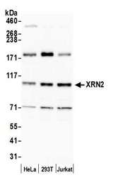 XRN2 Antibody - Detection of human XRN2 by western blot. Samples: Whole cell lysate (15 µg) from HeLa, HEK293T, and Jurkat cells prepared using NETN lysis buffer. Antibody: Affinity purified rabbit anti-XRN2 antibody used for WB at 0.04 µg/ml. Detection: Chemiluminescence with an exposure time of 30 seconds.